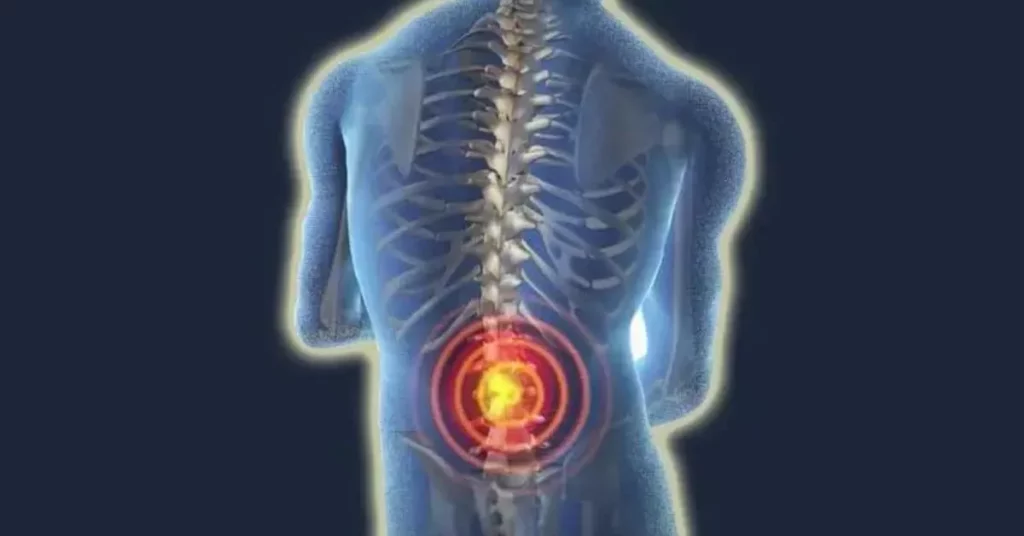 lower back pain causes